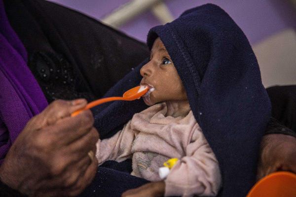 «الأغذية العالمي»: 16 مليون يمني يستيقظون كل يوم جوعى