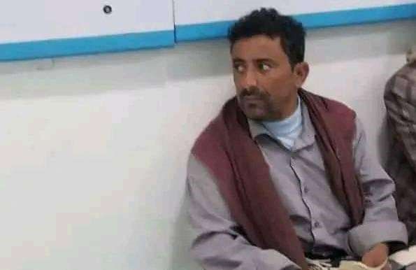 بعد أيام من جريمة مماثلة في صعدة.. وفاة مواطن في الضالع بالضرب المبرح من قِبل مليشيا الحوثي