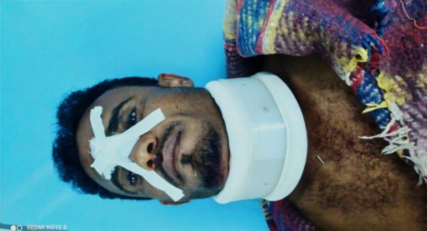 إصابة مدني بانفجار لغم حوثي فردي محرّم دوليًا زُرع داخل منزله جنوب الحديدة 