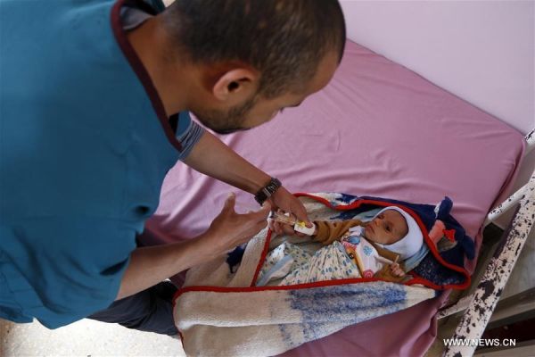 بينها اليمن.. الأمم المتحدة تطلق نداء لإنقاذ 30 مليون طفل يعانون سوء تغذية حاداً في 17 دولة