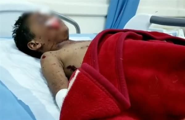 إصابة 3 مواطنين بانفجار لغم حوثي في تعز