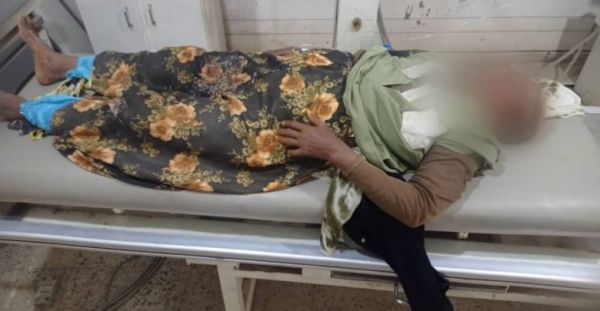 إصابة مواطنة في ال 50 من العمر بقصفٍ حوثيٍ على حيس 