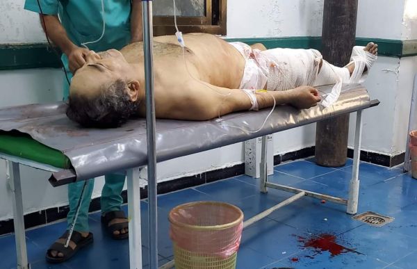 إصابة مواطن ستّيني برصاصة قناص حوثي شمالي مدينة تعز 
