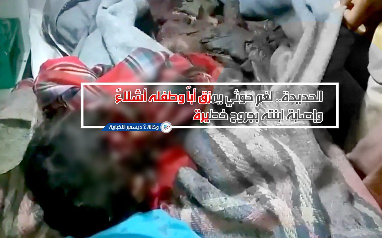 الحديدة.. لغم حوثي يمزق أباً وطفله أشلاءً وإصابة ابنته بجروح خطيرة