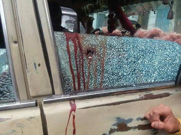 10 مدنيين بين شهيد وجريح إثر قصفٍ حوثيٍ في تعز
