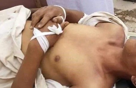 مقتل شاب على أيدي قيادي حوثي في صعدة