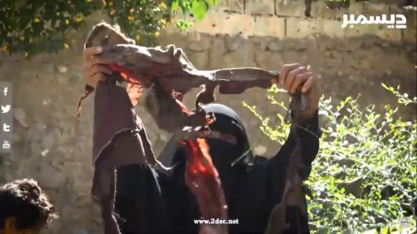 اليونيسف: مقتل وإصابة 113 طفلاً في اليمن منذ إعلان الهدنة 