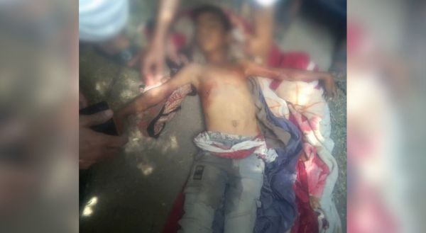 استشهاد طفل وإصابة آخر برصاص مشرف حوثي في تعز 