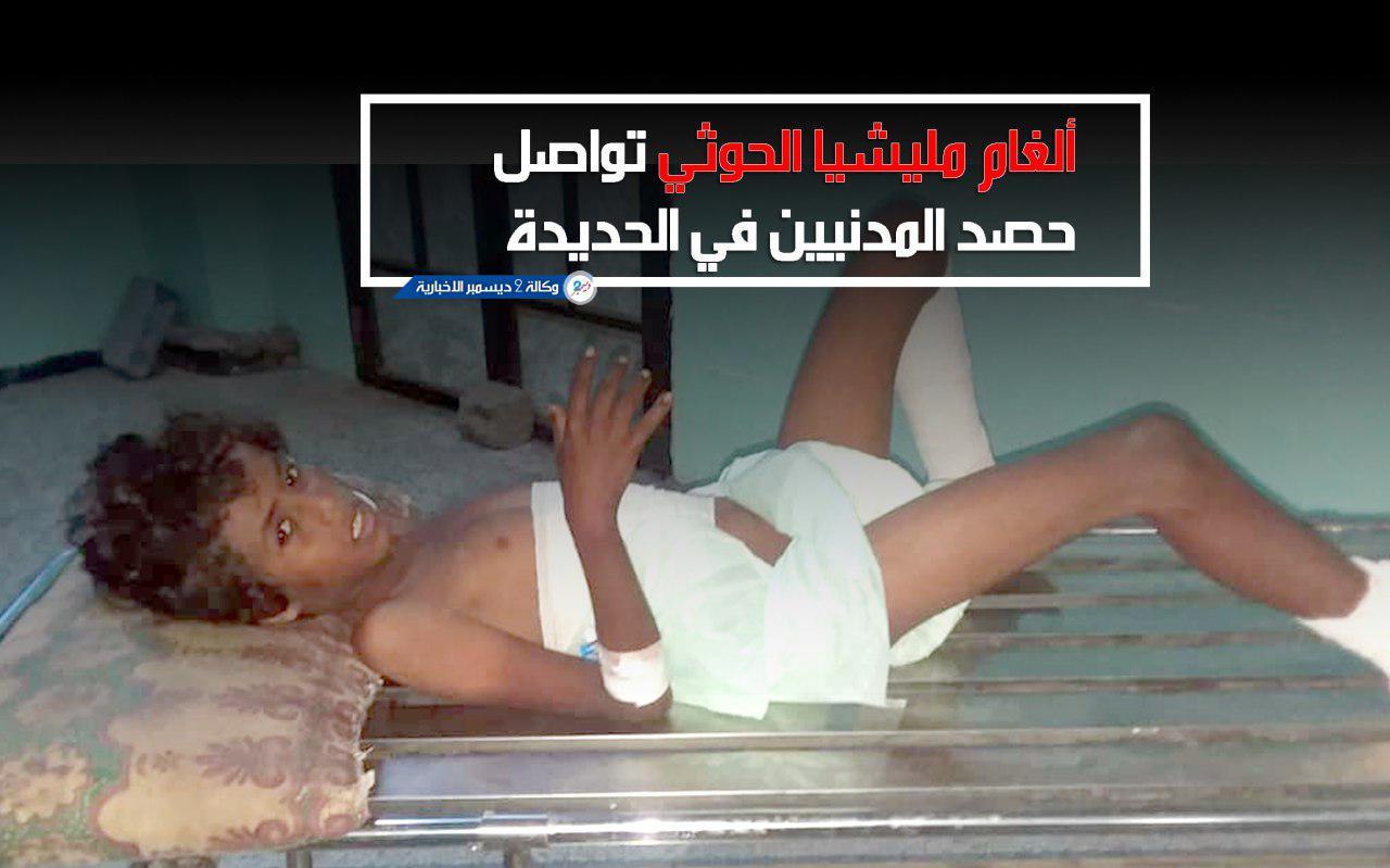 ألغام مليشيا الحوثي تواصل حصد المدنيين في الحديدة - محدث