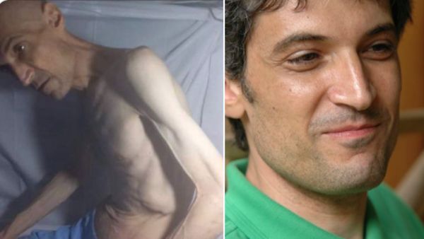 صورة أشبه بهيكل عظمي.. رسالة من ناشط مسجون بإيران