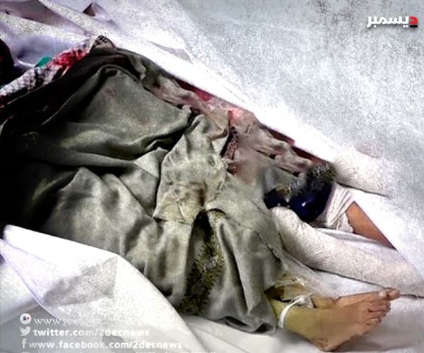 تصعيد ميليشيا الحوثي للعنف في 2020 خلف 19 ألف قتيل