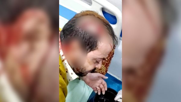 عصابات حوثية تعتدي على رجل أعمال رفض دفع إتاوات مالية 