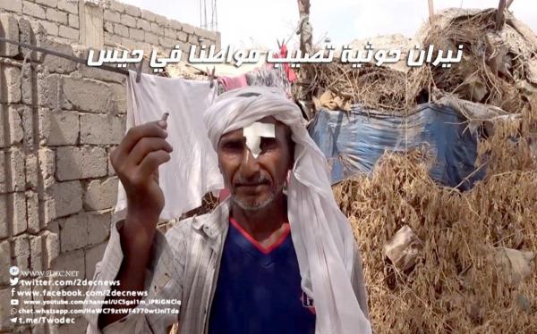 نيران حوثية تُصيب مواطنًا في حيس