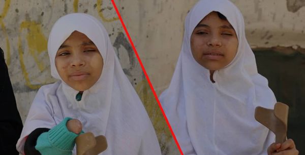 طفولة مسروقة بألغام الحوثيين ندى ونداء.. شقيقتان ضحيتا البحث عن الحطب في تعز