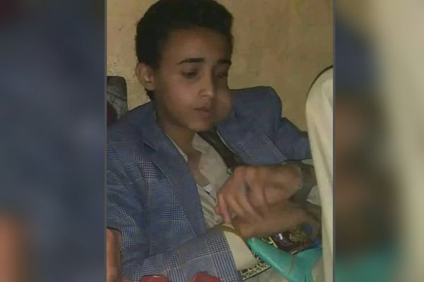 اختفاء طفل بصنعاء في ظروف غامضة 