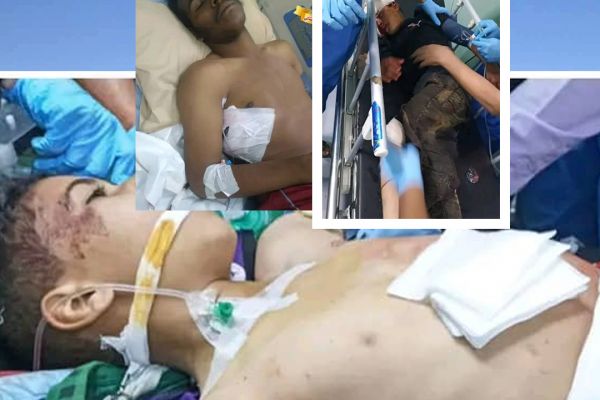 الضالع .. استشهاد طفل وإصابة آخرَيْن بقصف مُسيّر شنه الحوثيون على تجمعات سكانية 