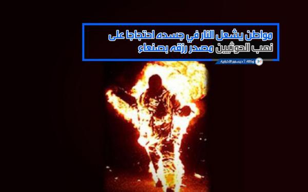 مواطن يشعل النار في جسده احتجاجا على نهب الحوثيين مصدر رزقه بصنعاء