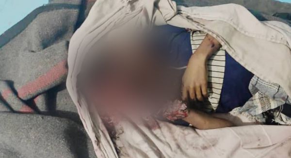 الحديدة.. استشهاد طفل وإصابة آخر جراء قصف حوثي على حيس 