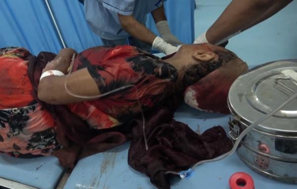 إصابة امرأة مسنة بقذيفة هاون أطلقتها المليشيات الحوثية في الريف الجنوبي للحديدة