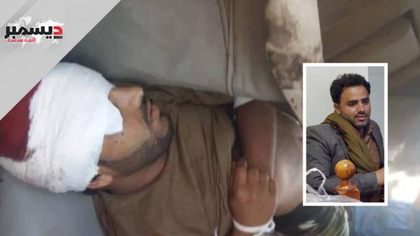 مسلح حوثي يردي شاباً بسبب قطرات ماء وقعت على ثيابه