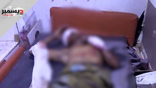 إصابة عامل بانفجار لغم حوثي في ذوباب