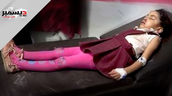 قناص حوثي يصيب طفلة بجروح خطيرة شرق مدينة تعز