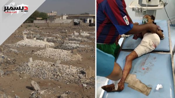 استشهاد طفلة من ضحايا جريمة الحوثيين بحيس والإرياني يدعو الأمم المتحدة لإدانة صريحة