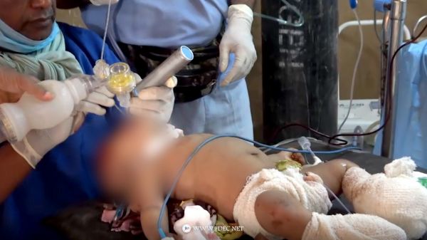 تقرير أممي يكشف عن أعلى حصيلة شهرية للضحايا المدنيين في اليمن منذُ 3 سنوات 