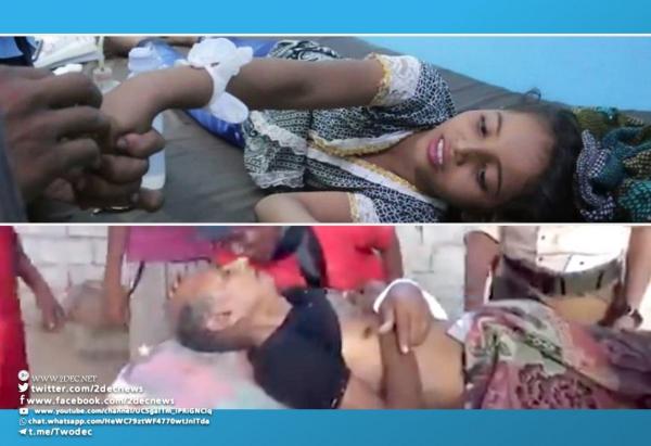 الحديدة.. ثاني جريمة حوثية بحق المدنيين في حيس خلال ساعات