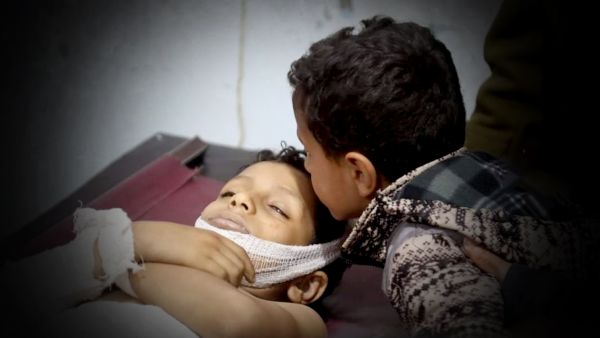 تصاعد الضحايا الأطفال السنوات الأخيرة.. هجمات الحوثي قتلت 44 مدنياً وجرحت 67 خلال فبراير 