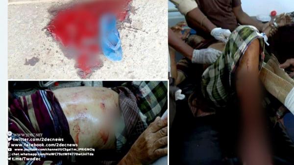 إصابة 7 عمال بقصف مدفعي حوثي على أكبر مجمع صناعي وتجاري في الحديدة