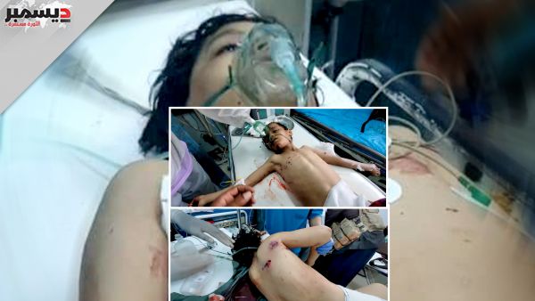 استشهاد طفل وإصابة 5 مدنيين آخرين بشظايا صاروخ حوثي على مدينة مأرب