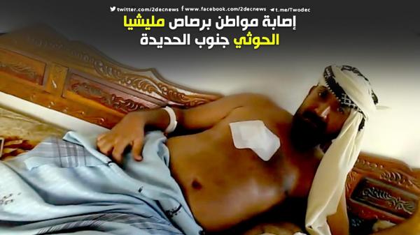 إصابة مواطن برصاص مليشيا الحوثي جنوب الحديدة