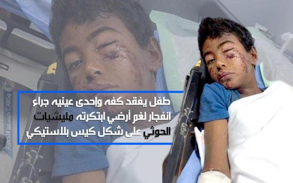 مليشيات الحوثي تتفنن في صناعة ألغام للأطفال تثير فضولهم للعبث بها
