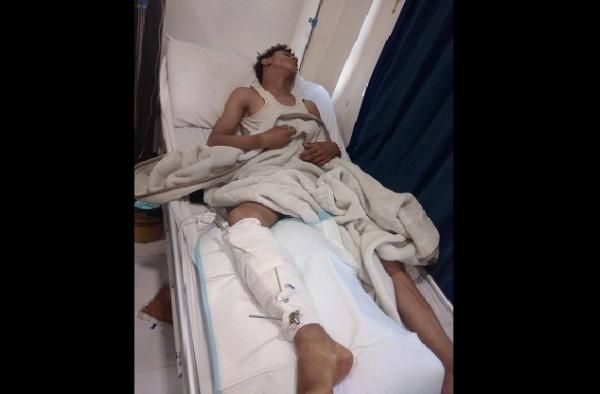 جريمة جديدة لمليشيا الحوثي في إب