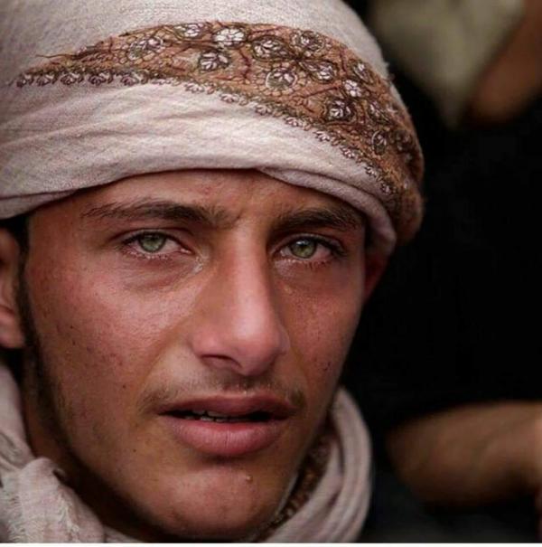 صورة تجسد معاناة وطن