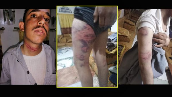 صور| الأخلاق الحوثية تتسرب للمجتمع اليمني.. تعذيب بشع لشاب بسبب «علاقية» قات