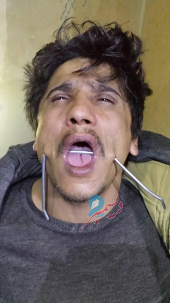وكالة 2 ديسمبر تحصل على صور حصرية لتعذيب المليشيا الحوثية لمعتقل في عمران (طالع الصور)