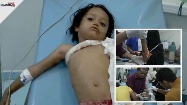 "حقوق الإنسان" في حيس يدين جريمة قصف الحوثيين أحياء سكنية وإصابتها أطفال ونساء