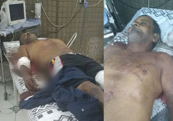 المليشيات الحوثية ترتكب جريمة بحق المدنيين في الحديدة وقت السحور