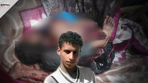 في مرعى الماشية... لغمٌ يريق دماء الرعاة وعناصر حوثية تغنم مواشيهم
