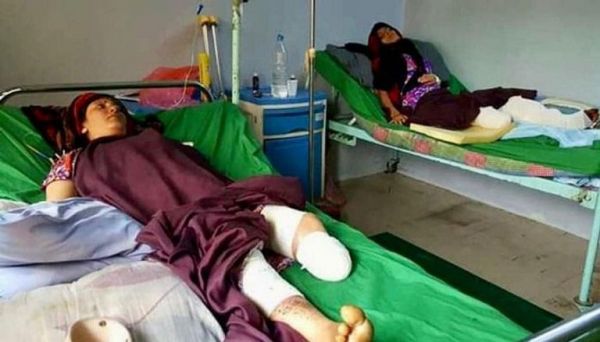 مقتل امرأة وطفلة وإصابة ثالث بانفجار لغمين حوثيين في تعز وصعدة