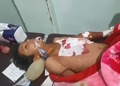 استشهاد وإصابة أربعة أطفال وامرأة في قصف حوثي على قرى بالضالع
