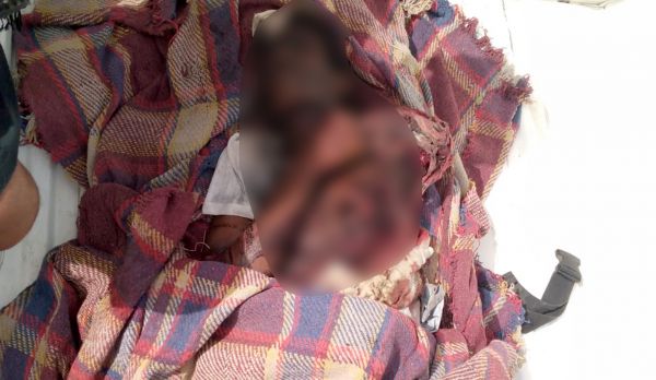 لغم حوثي يمزِّق جسد راعي أغنام ونجاة آخر غربي تعز (صورة) 
