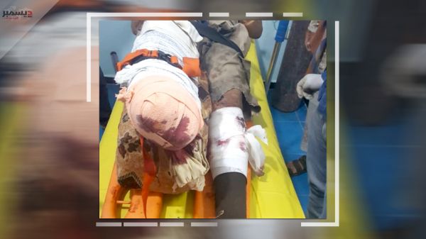 بُترت قدمه اليمنى.. إصابة أحد مهندسي "مسام" بانفجار لغم حوثي بالوازعية 