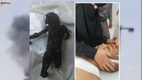 إحصاءات رسمية تؤكد استشهاد وإصابة 19 مدنياً بالقصف الحوثي على مدينة مأرب 