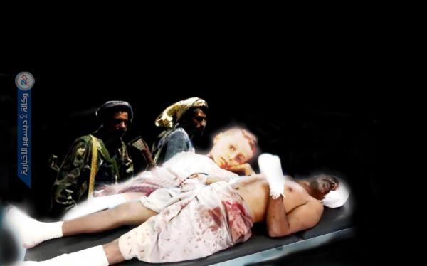 400 قتيل وجريح من المدنيين بالهجمات الأخيرة لمليشيا الحوثي في تعز والضالع