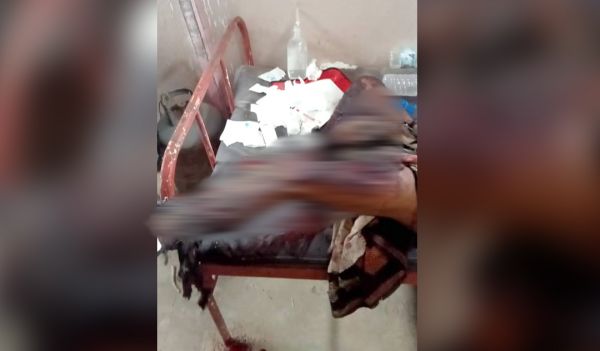 لغم حوثي ينهي حياة مواطن من أهالي ذوباب المندب 