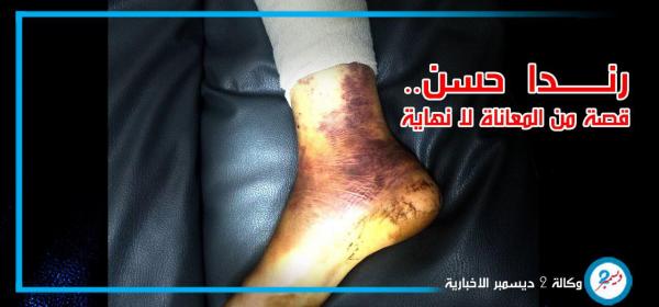 رندا حسن.. قصة من المعاناة لا نهاية لها: دعوات مستغيثة تطلب إنقاذها