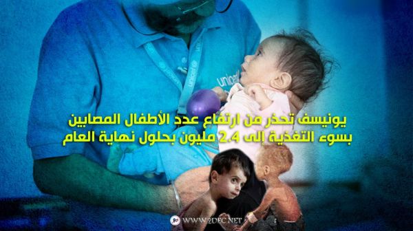 يونيسف تحذر من ارتفاع عدد الأطفال المصابين بسوء التغذية إلى 2.4 مليون بحلول نهاية العام 
